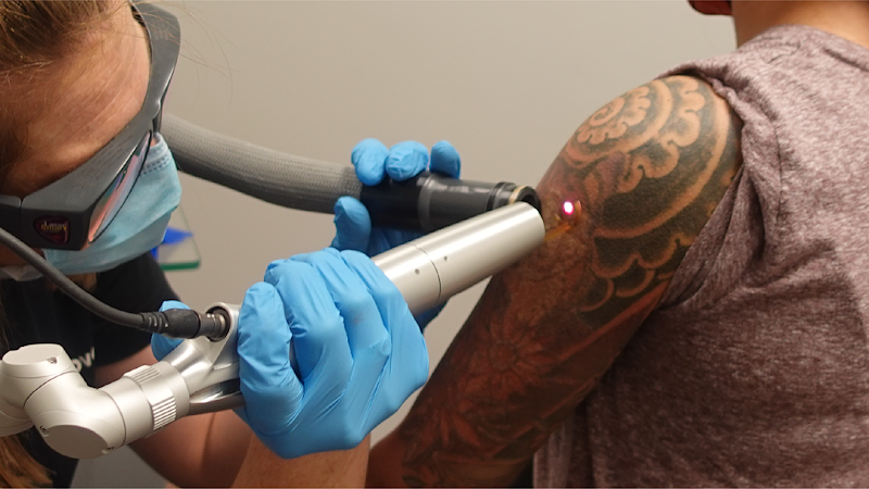 Removery Tattoo Removal & Fading tattoo shop in Brooklyn, New York