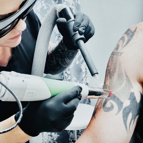 Denton Laser Tattoo Removal tattoo shop in Denton, Texas