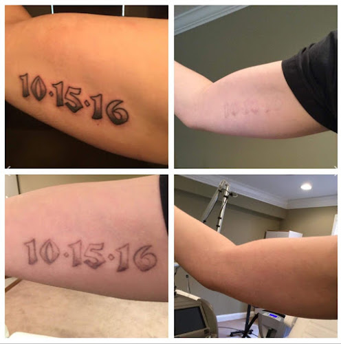 Lexington Tattoo Removal tattoo shop in Lexington, Kentucky