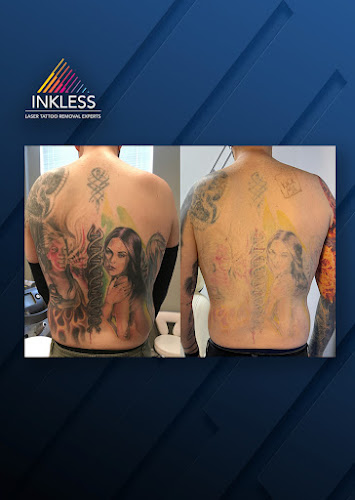 Inkless Tattoo Removal tattoo shop in Philadelphia, Pennsylvania