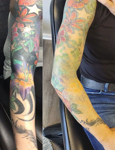 Rochester Tattoo Removal tattoo shop in Rochester, New York