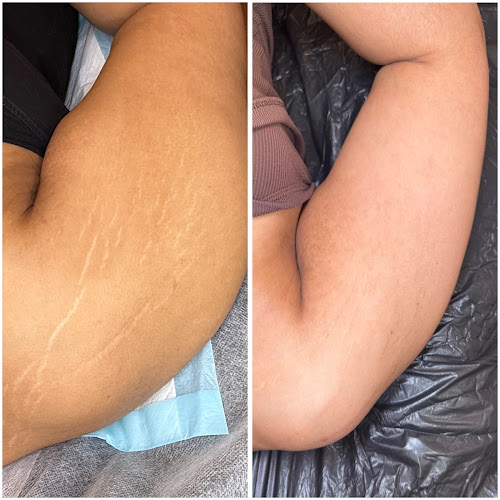 MICROBAE tattoo shop in Seattle, Washington